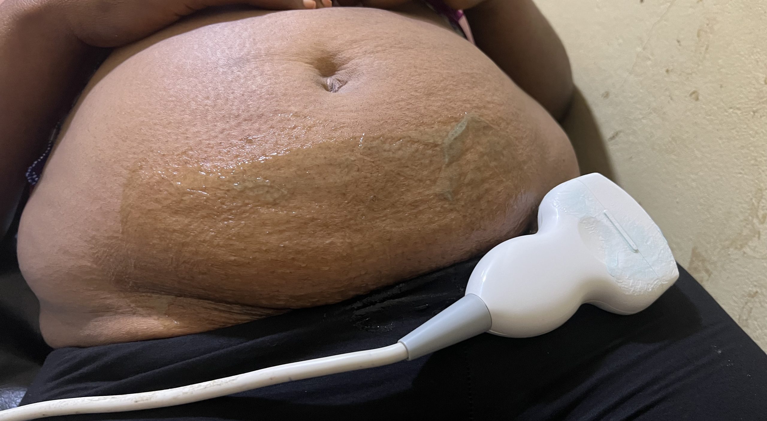 Talk Pregnancy with Dr Noella 2